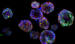 首個鼻咽癌3D類器官模型!用于精確的治療